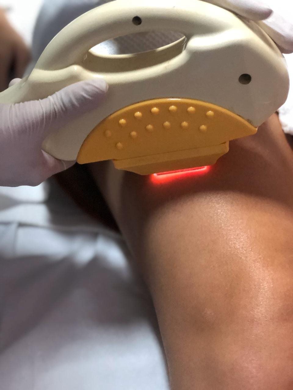 Tecnologia aplicada em tratamento corporal